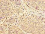 SUCLA2 Polyclonal Antibody