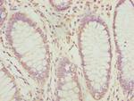 PDCD2L Antibody in Immunohistochemistry (Paraffin) (IHC (P))