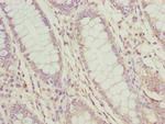 PDCD2L Antibody in Immunohistochemistry (Paraffin) (IHC (P))