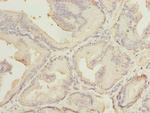 MED18 Polyclonal Antibody