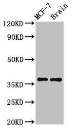 MENT Antibody in Western Blot (WB)