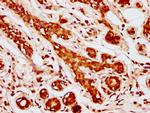 MOB1 Antibody in Immunohistochemistry (Paraffin) (IHC (P))