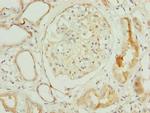 NOLA3 Polyclonal Antibody