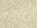 GEMIN8 Polyclonal Antibody