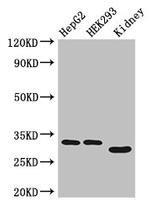 GEMIN8 Antibody in Western Blot (WB)