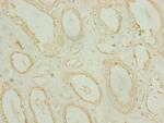 CHCHD3 Polyclonal Antibody