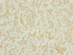 CHCHD3 Antibody in Immunohistochemistry (Paraffin) (IHC (P))