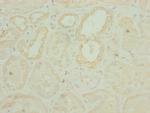 CHCHD3 Antibody in Immunohistochemistry (Paraffin) (IHC (P))