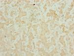 CHCHD3 Antibody in Immunohistochemistry (Paraffin) (IHC (P))