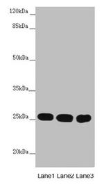 CHCHD3 Antibody in Western Blot (WB)