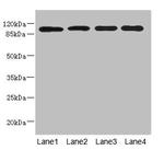 USP26 Antibody in Western Blot (WB)