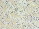 MIS12 Polyclonal Antibody