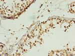 MIS12 Antibody in Immunohistochemistry (Paraffin) (IHC (P))