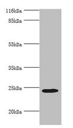 MIS12 Antibody in Western Blot (WB)