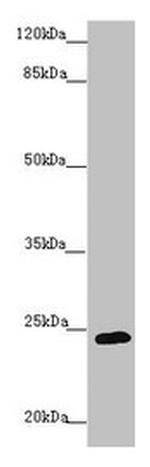 GRPEL1 Antibody in Western Blot (WB)