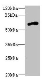 NRXN3 Antibody in Western Blot (WB)