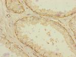 RAB18 Polyclonal Antibody