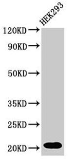 RPS10P5 Antibody in Western Blot (WB)