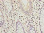 RPRD1B Polyclonal Antibody