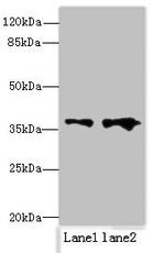 RPRD1B Antibody in Western Blot (WB)