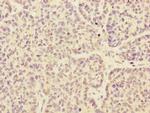 ARHGEF3 Polyclonal Antibody