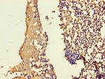 ASF1B Polyclonal Antibody