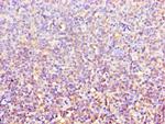 ACTR3B Polyclonal Antibody