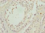 CALCOCO1 Polyclonal Antibody