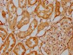 EFHD1 Antibody in Immunohistochemistry (Paraffin) (IHC (P))