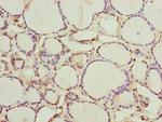 CEP44 Polyclonal Antibody