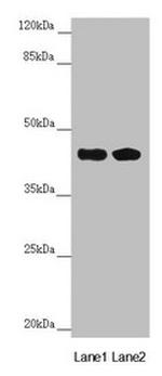 CEP44 Antibody in Western Blot (WB)