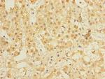 ALS2CR1 Polyclonal Antibody