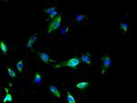 SLC25A18 Polyclonal Antibody