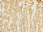 SLC25A18 Antibody in Immunohistochemistry (Paraffin) (IHC (P))