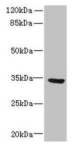 SLC25A18 Antibody in Western Blot (WB)