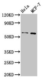 MMP28 Antibody in Western Blot (WB)