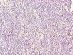SH3BGRL3 Antibody in Immunohistochemistry (Paraffin) (IHC (P))