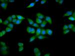 PRDM11 Polyclonal Antibody