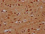 PRDM11 Antibody in Immunohistochemistry (Paraffin) (IHC (P))