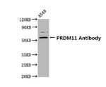 PRDM11 Antibody in Western Blot (WB)