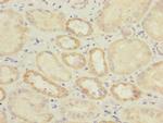 IL17RB Polyclonal Antibody