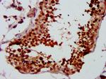 LYAR Antibody in Immunohistochemistry (Paraffin) (IHC (P))