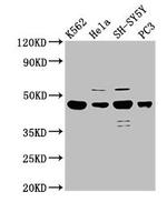 LYAR Antibody in Western Blot (WB)