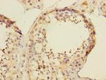 ATXN10 Antibody in Immunohistochemistry (Paraffin) (IHC (P))