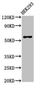 RBPJL Antibody in Western Blot (WB)