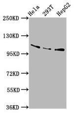 AASS Antibody in Western Blot (WB)