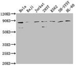 ZRANB1 Antibody in Western Blot (WB)