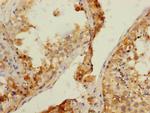 NRBP Antibody in Immunohistochemistry (Paraffin) (IHC (P))