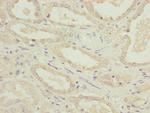 NDUFA12 Antibody in Immunohistochemistry (Paraffin) (IHC (P))