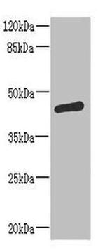ST6GALNAC2 Polyclonal Antibody
